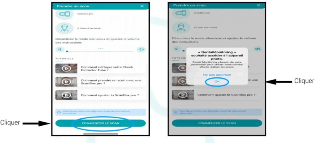 Recommandations DentalMonitoring Aligneurs