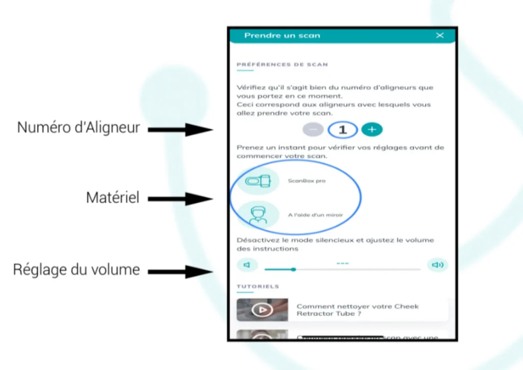 Recommandations DentalMonitoring Aligneurs