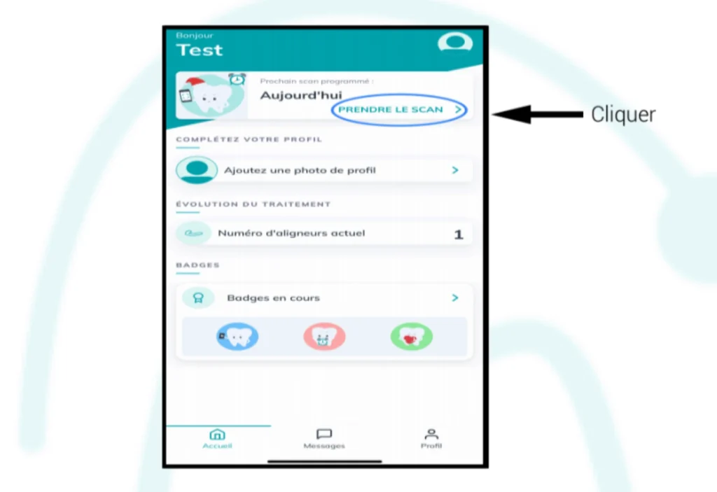 Recommandations DentalMonitoring Aligneurs