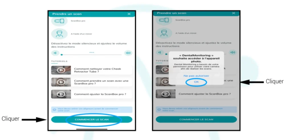 Recommandations DentalMonitoring Bagues