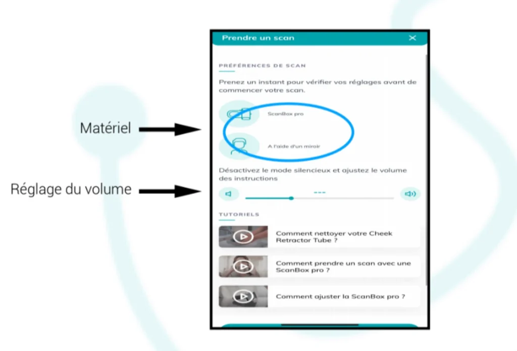 Recommandations DentalMonitoring Bagues