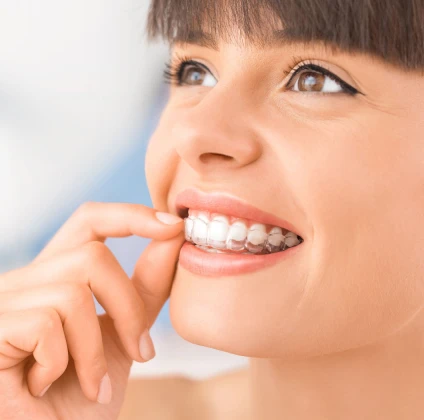 Recommandations DentalMonitoring Aligneurs, orthodontie de l'adulte au cabinet du Dr Sebbag