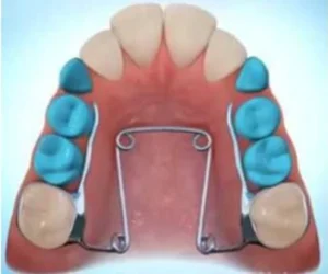 Recommandations QuadHelix